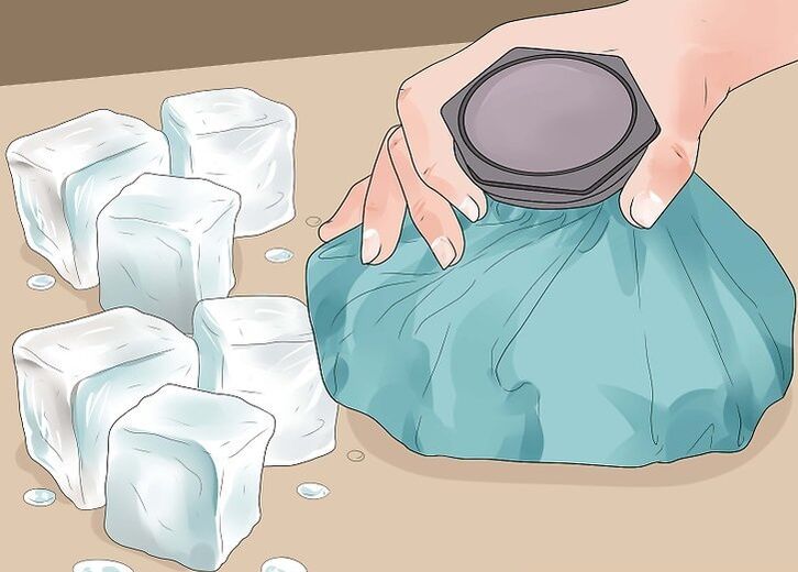 Icing